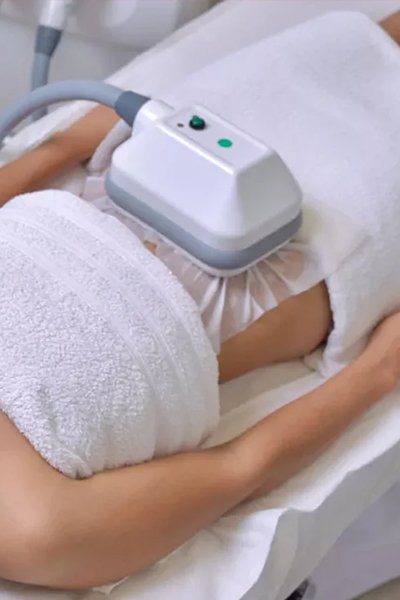 CryoSculpt
